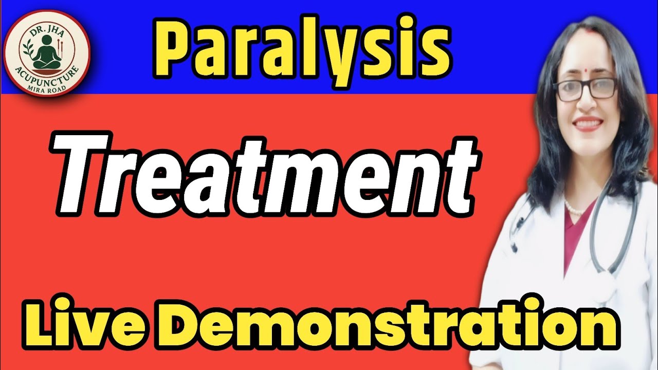 Acupuncture Therapy: Paralysis में कैसे मिल सकती है मदद? Live Demo