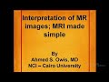 Interpretation of mr images mri made simple ii