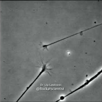 FINDING THAT CONNECTION© - neurons connecting to one another in a Petri dish - growth cones