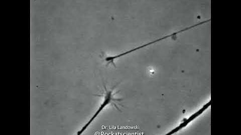 FINDING THAT CONNECTION© - neurons connecting to one another in a Petri dish - growth cones