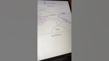 Pancreas Lab Assignment featuring my patient Bumi