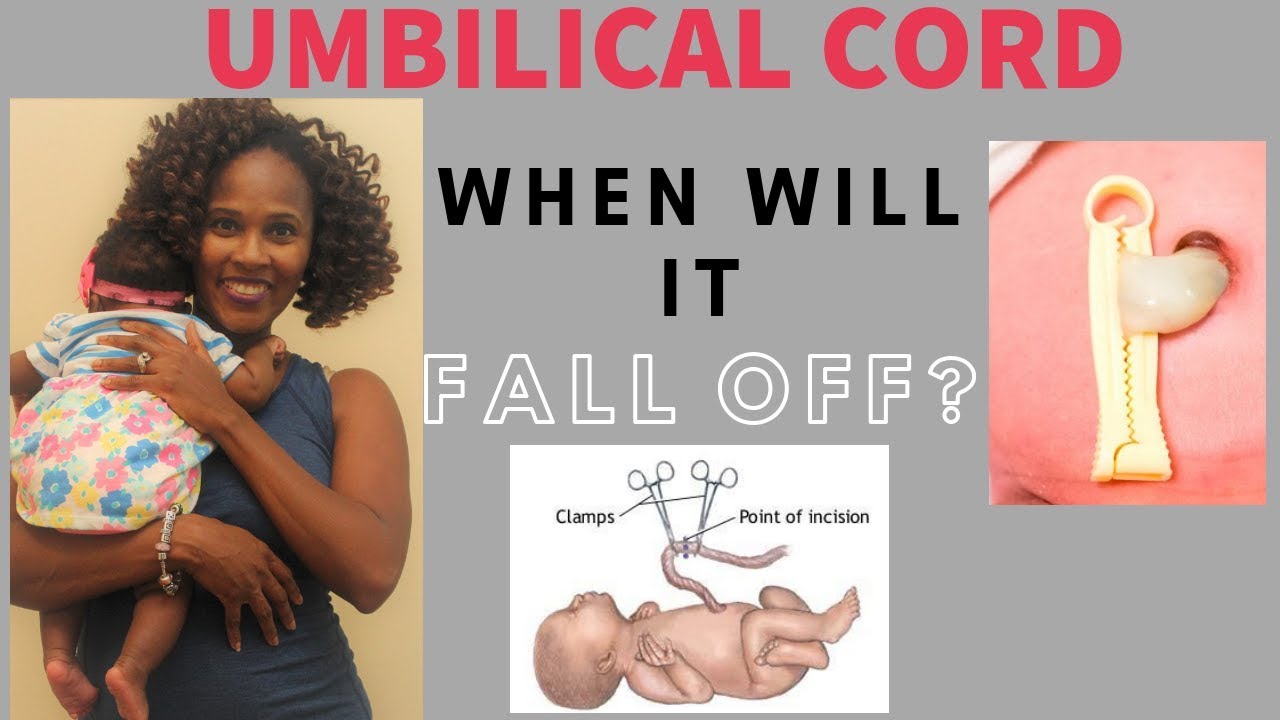 How many days before umbilical cord falls off. YouTube
