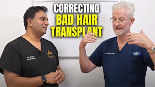 Correcting Poor Hair Transplant Surgery