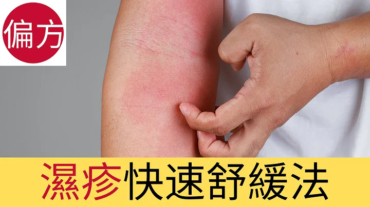 湿疹应该搽什么? - 天天要闻