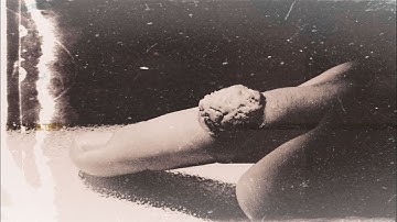 T. - Wart (2024) - 𝘌𝘗