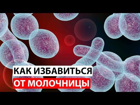 Как вылечить молочницу у женщин навсегда