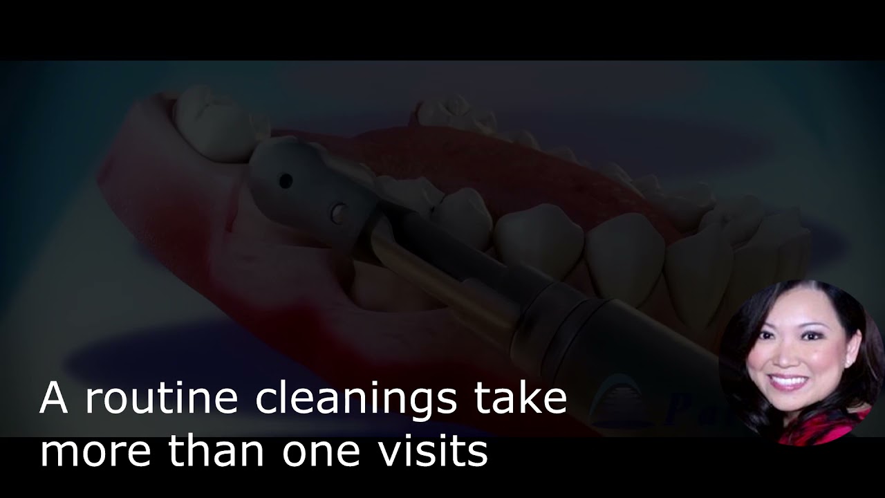 DEEP CLEANING Scaling and Root Planing vs Regular Teeth Cleaning (SRP