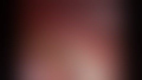 Laparoscopic Metastatectomy for Metastatic GIST from liver  by Dr Hitesh Chavda, Ahmedabad