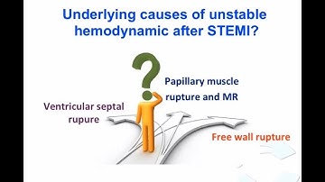 #04 Siêu âm tim cấp cứu tại giường. ThS. BS. Văn Đức Hạnh