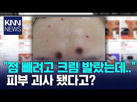 &amp;quot;바르면 점 사라진다더니...&amp;quot; / KNN