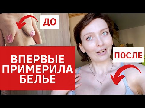 Video: Anastasia o výsledkoch plastickej chirurgie