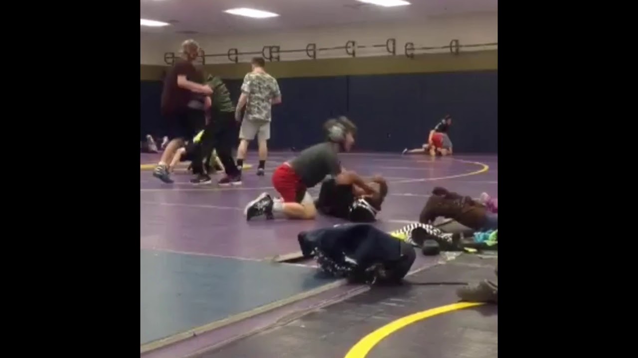 Tib-Fib Spiral Fracture - YouTube