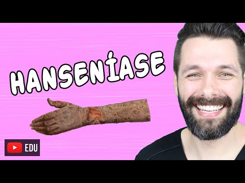 Vídeo: Por que a hanseníase é chamada de hanseníase?
