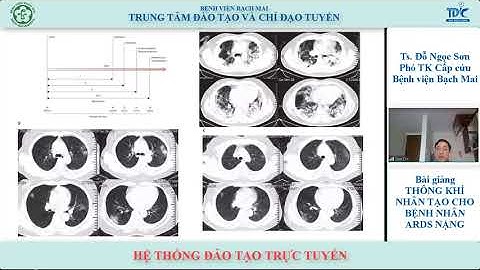 Thông khí nhân tạo cho bệnh nhân ARDS nặng