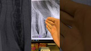 No Cbct. Brought Receipts.