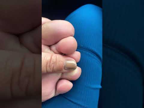 Zoomed in toe massage #feetcommunity #toes #feetmatter #barefoot