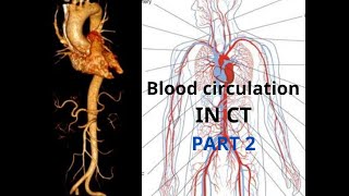 شرح الدورة الدموية ومسار الصبغة في الأوردة والشرايين للأشعة المقطعية CT(الجزء الثاني)