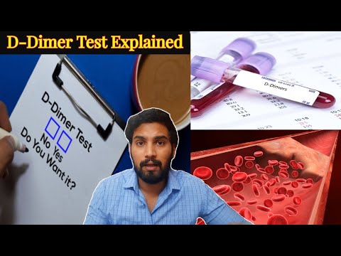 वीडियो: मैं अपने लस्ट्रॉन मेस्ट्रो डिमर को कैसे रीसेट करूं?