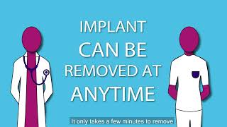 NHS Contraceptive Implant Information Video
