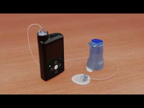 Inserting the Medtronic Extended™ infusion set