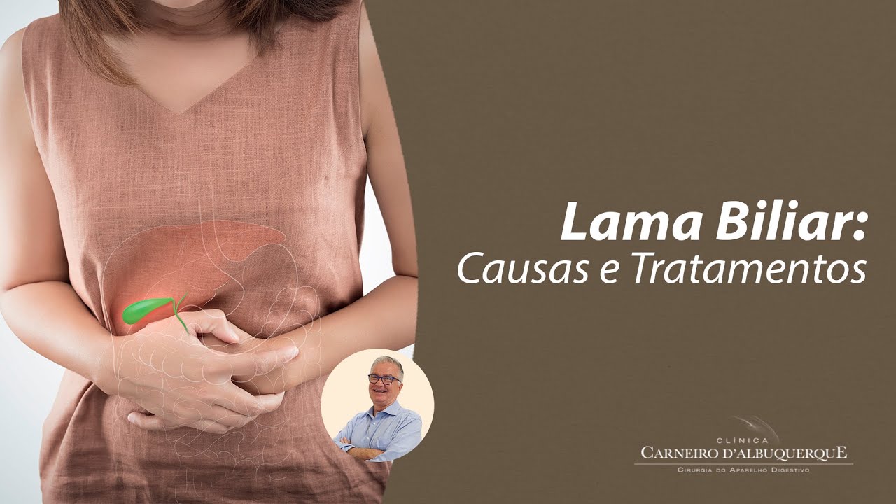 Lama Biliar: Causas e Tratamentos | Prof. Dr. Luiz Carneiro CRM 22761 ...