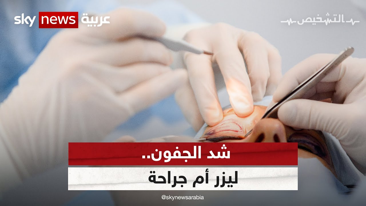 شد الجفون خطوة بخطوة من داخل غرفة العمليات  | #برنامج_التشخيص