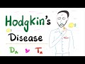 Hodgkin’s Disease (Lymphoma); Diagnosis & Treatment