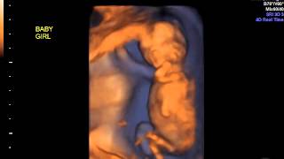 IMG 20150428 1 6 VolCine