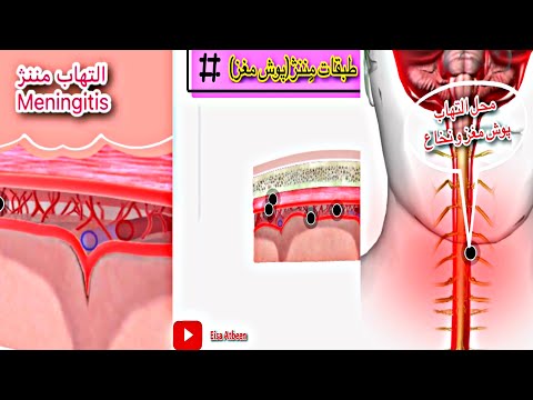 تصویری: التهاب مغز و نخاع (Polioencephalomyelitis) در گربه ها