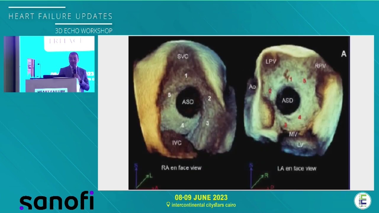 3D ECHO Course Part 2