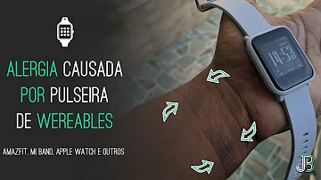 O que passar no relógio para não dar alergia?