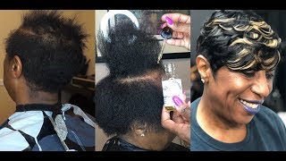 HOW TO QUICKWEAVE WITH RELAXED SIDES AND BACK | GREAT STYLE FOR ALOPECIA