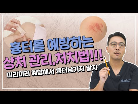 61화. 흉터를 예방하는 상처관리, 처치법!! 미리미리 예방해서 흉터남기지 말자