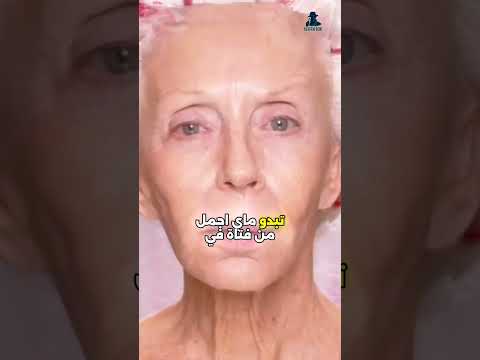 ماي ألين واي سيدة المئة عام التي تتحدى الزمنColleen Heidemann 