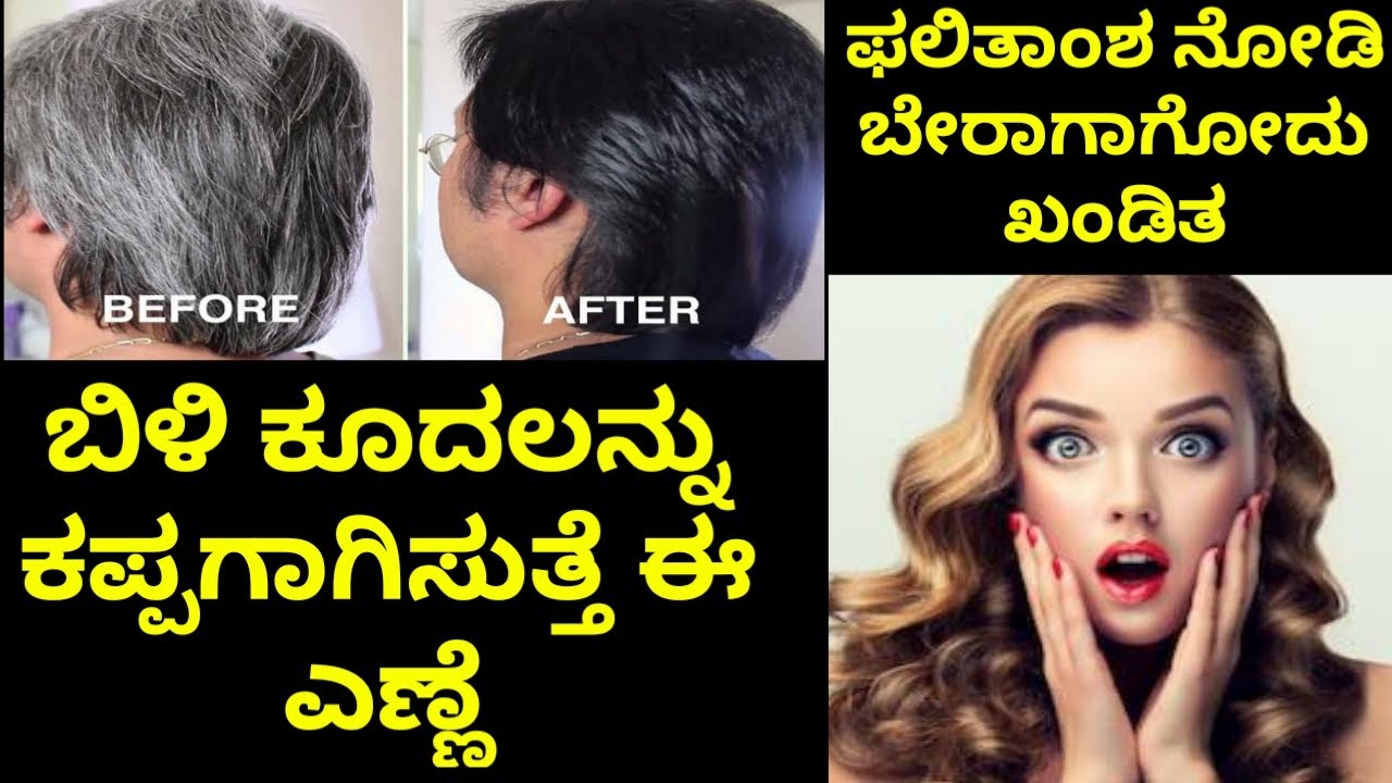 ಚಿಕ್ಕ ವಯಸ್ಸಿನಲ್ಲೇ ಕೂದಲು ಬಿಳಿ ಆಗುತ್ತಿದೆಯೇ? | White Hairs in Early Age | Hair  Care Tips in Kannada - YouTube