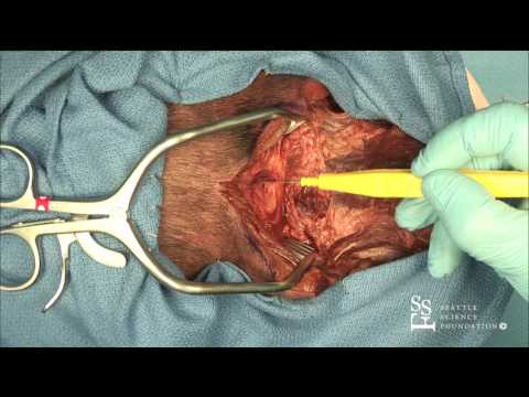 Video: Arnold-Chiari-Anomalie - Behandlung, Operation, Symptome