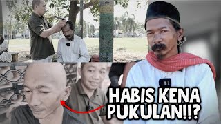 Download Lagu PIPI MATA DAN TELINGA KENA PUKUL ❗️😱❓️ MP3 Download Lagu PIPI MATA DAN TELINGA KENA PUKUL ❗️😱❓️ MP3