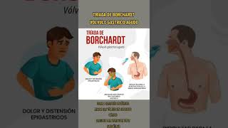 Triada de Borchardt / Vólvulo gástrico agudo viral triadas medicine volvulo