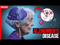 💡ప్రతి విషయాన్ని మర్చిపోతున్నారా?💡ALZHEIMER's : Causes, Symptoms, and Treatments || ZOOMED || Telugu