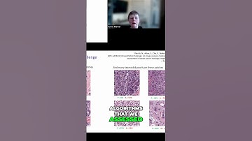 AI vs Pathologists: Who Scores Better