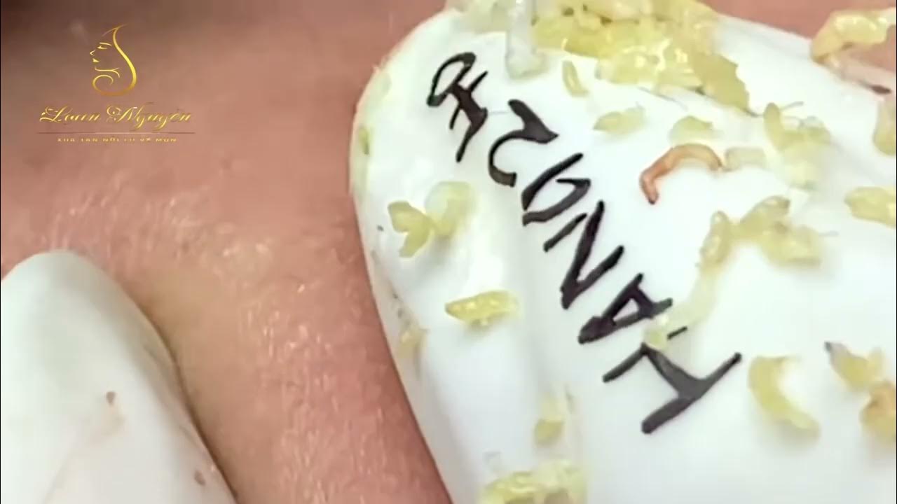the-importance-of-a-healthy-diet-for-clear-skin-youtube