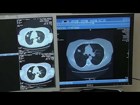 Video: Kanser Tespitine Yönelik Yeni Yaklaşımlar
