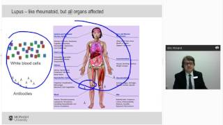 The Diagnosis and Management of Lupus