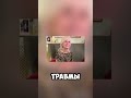 Женщина, которая не чувствует боли #наука #удивительныеистории #удивительное