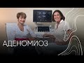 Аденомиоз | Людмила Шупенюк и Волик Нелла