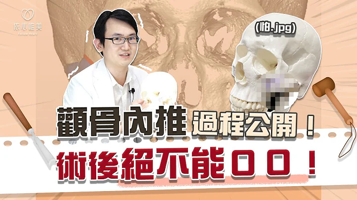 颧骨削骨后遗症多？术后照顾麻烦？上削骨解决“骨感”问题！｜依心唯美 谢东颖医师 - 天天要闻