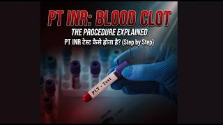 PT INR टेस्ट Procedure Explained | PT INR टेस्ट कैसे होता है ? (Step by Step)