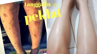 HOW TO REMOVE SCARS  AT HOME|| PAANO MAALIS ANG PEKLAT? try this|| Ms Sungit