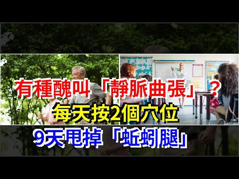 有種醜叫“靜脈曲張”？每天按2個穴位，9天甩掉“蚯蚓腿”