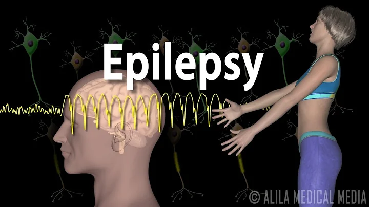 Epilepsy: Types of seizures, Symptoms, Pathophysiology, Causes and Treatments, Animation. - DayDayNews